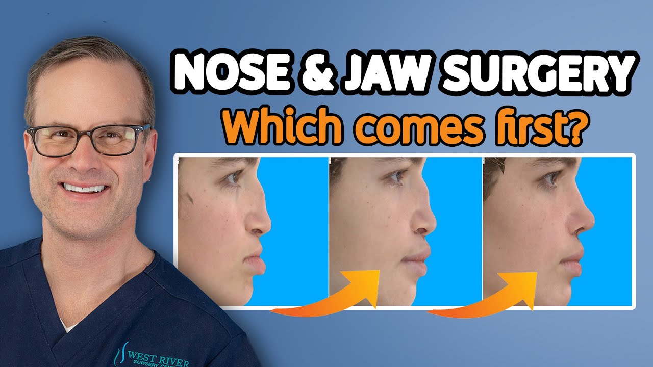 How Jaw Surgery Affects the Nose | Rhinoplasty & Orthognathic Surgery Explained