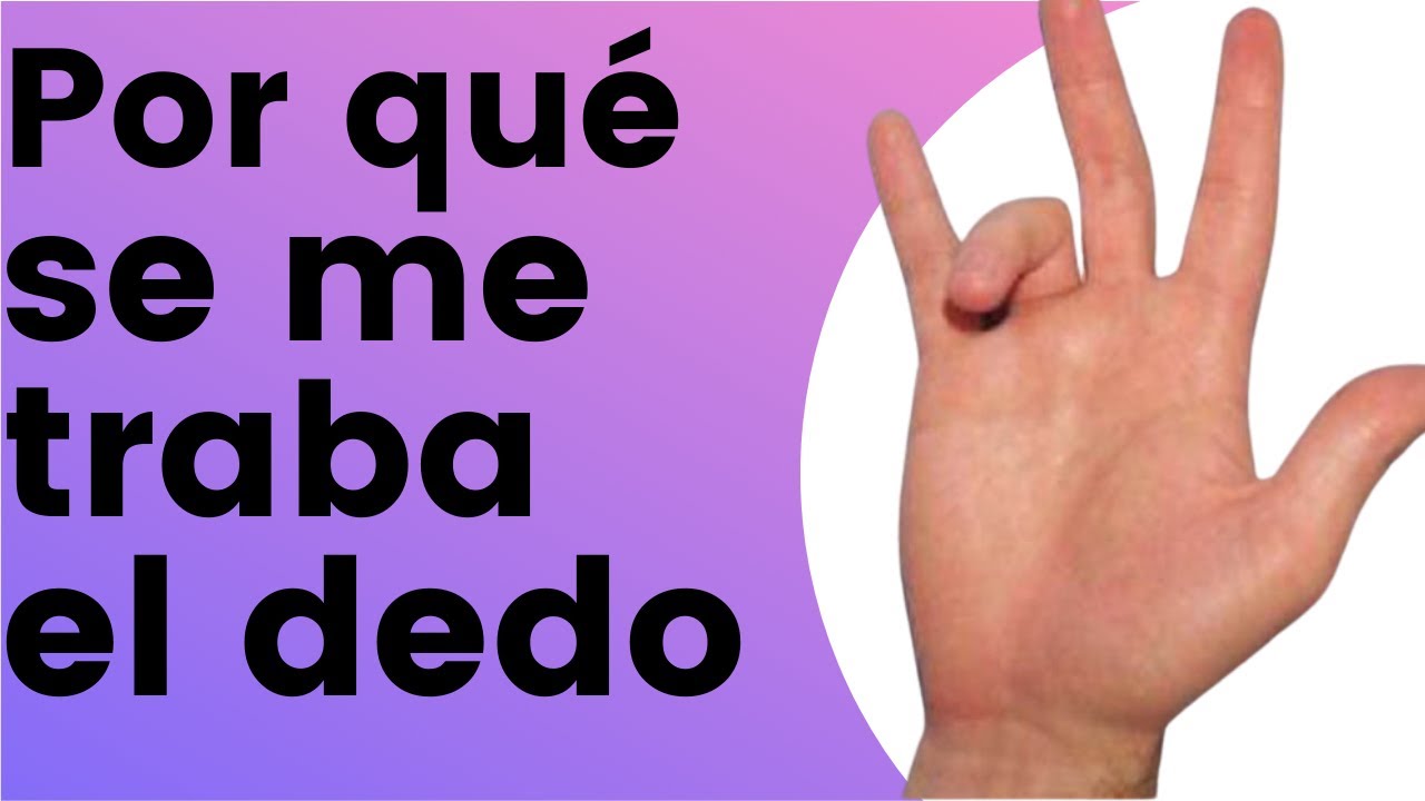 Por qu&eacute; se me traba el dedo de la mano