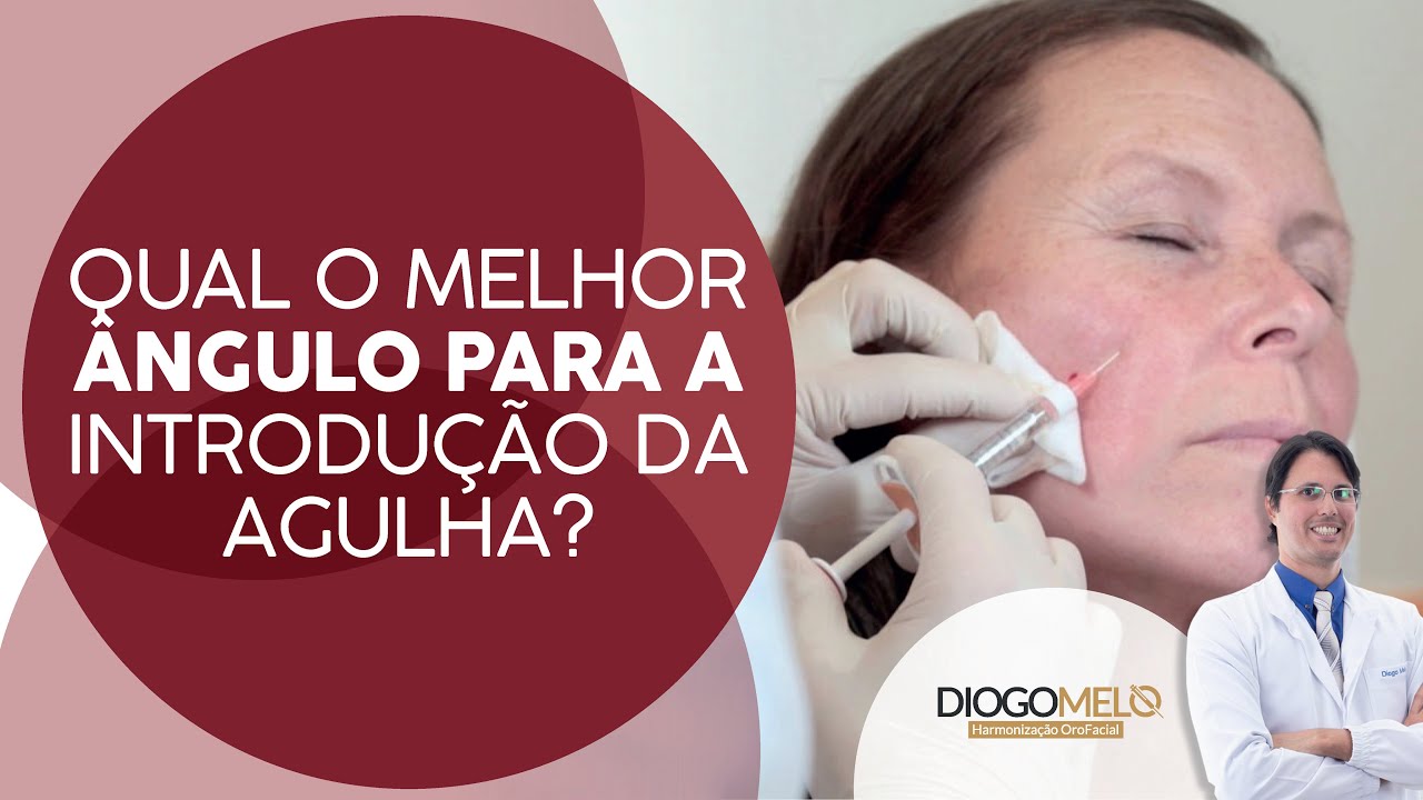 90º ou 45º Qual a melhor ângulo para a aplicação?