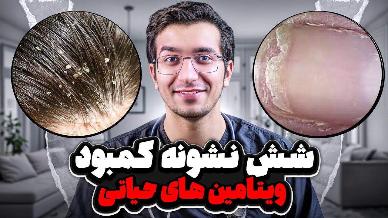 عوارض و علائم کمبود ویتامین های حیاتی در بدن چیست؟