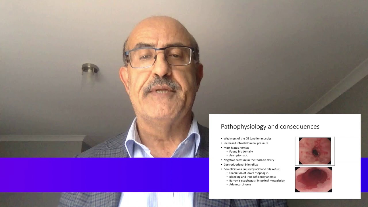 Reflux Esophagitis