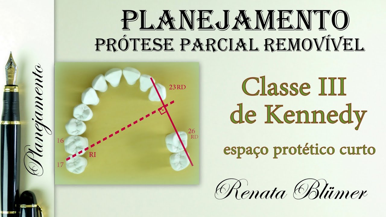 PLANEJAMENTO CLASSE III DE KENNEDY (CURTO)