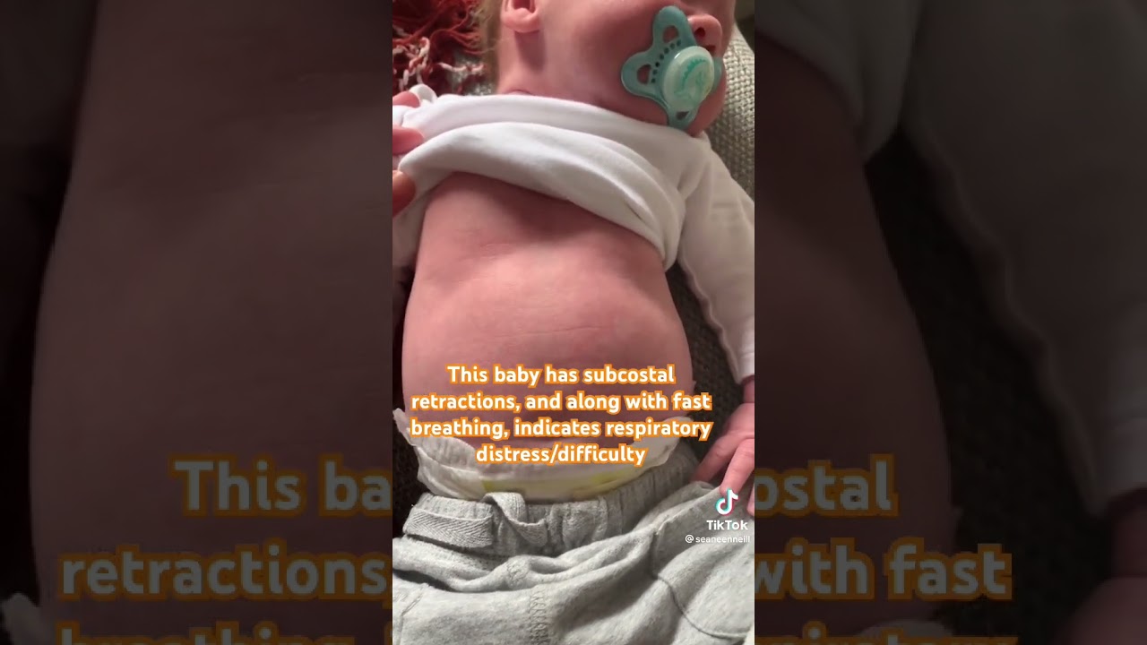 Fast breathing in baby | Breathing difficulty | Chest retractions