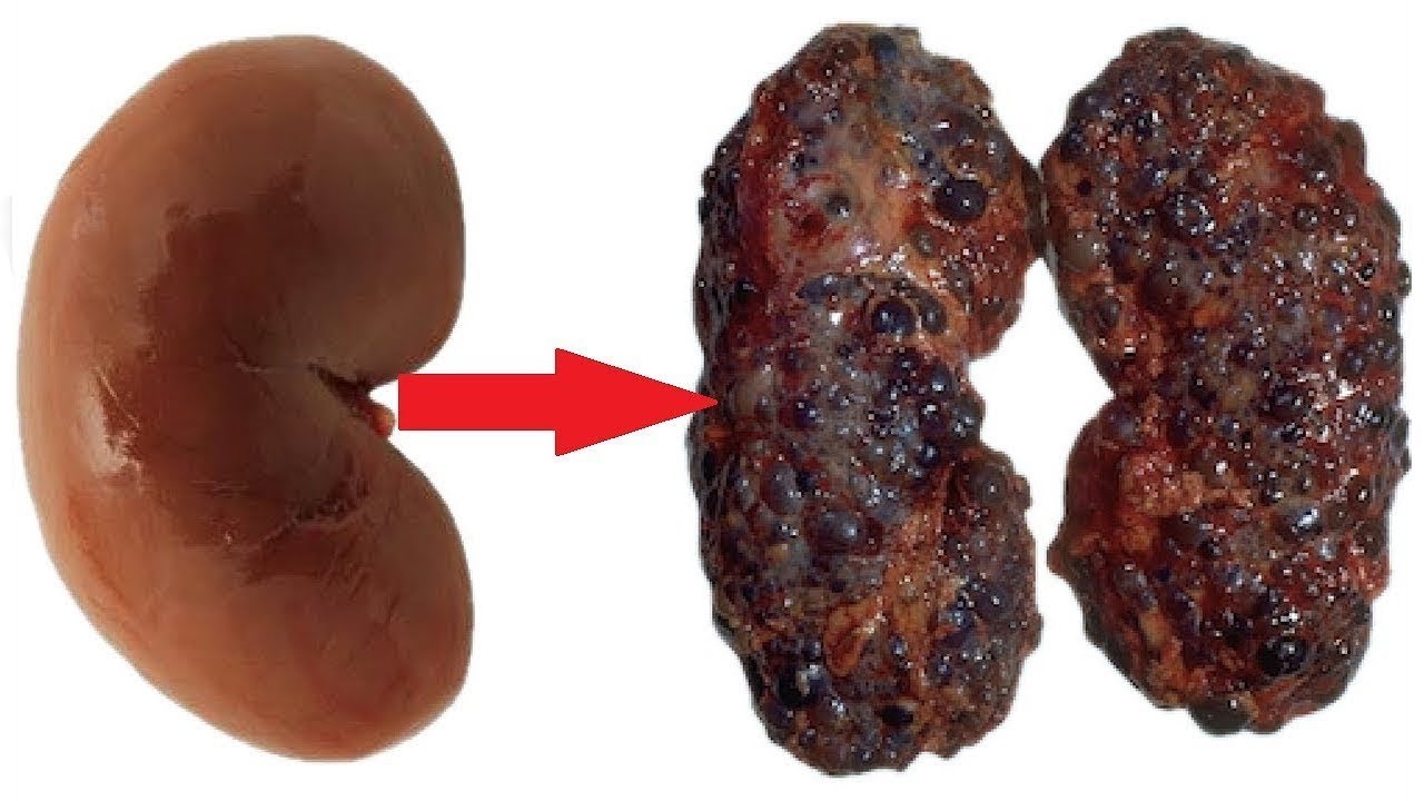 B&ouml;breklere Zarar Veren 10 Tehlikeli Alışkanlık - &Ccedil;oğu Kişi Farkında Değil.