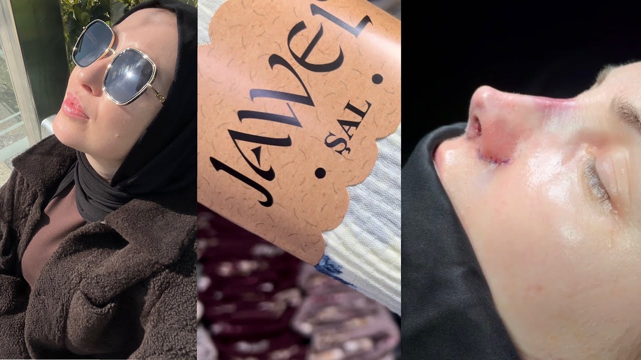 Ринопластика в Стамбуле😍 JAWEL платки. Обзор цен. Первый весенний влог🥰