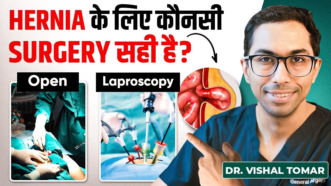 Hernia Surgery कौनसी सही है? | Open vs Laparoscopic Hernia Surgery