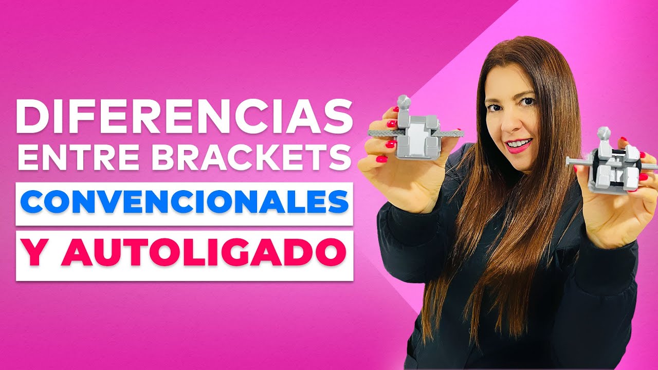 Diferencias entre Brackets Convencionales y Autoligado