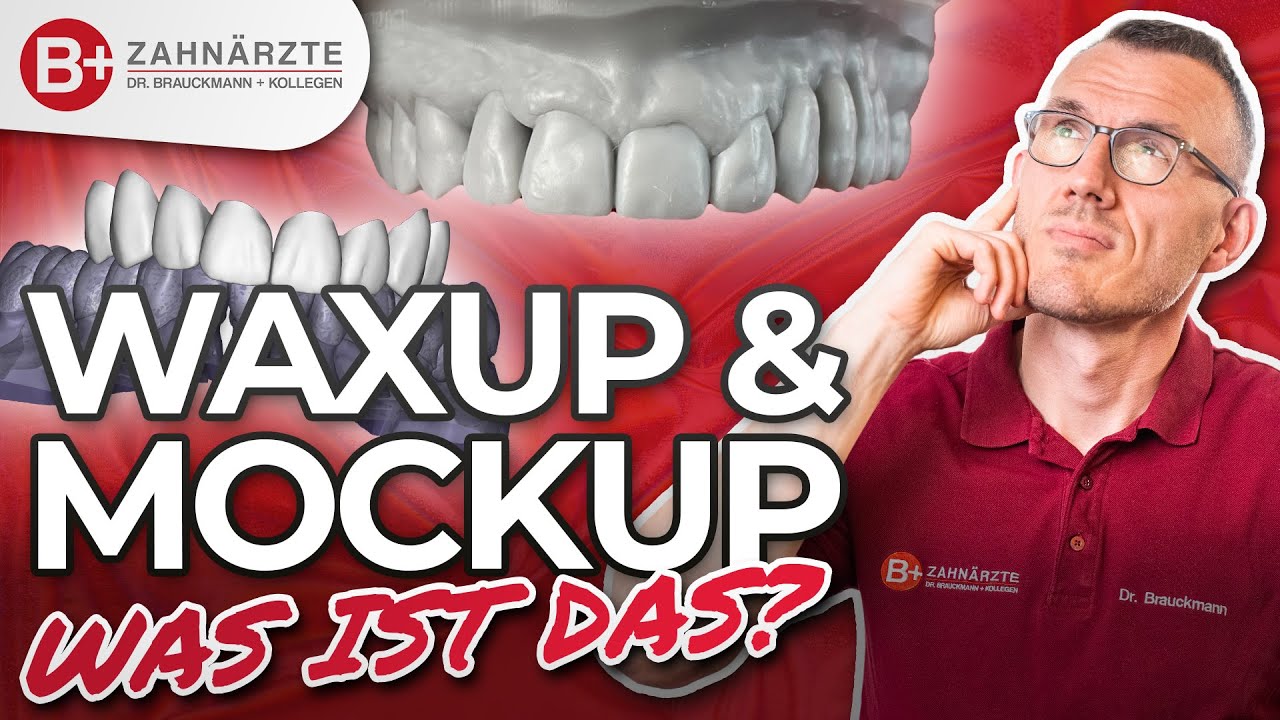 Alles &uuml;ber Wax Up & Mock Up! - erkl&auml;rt vom Zahnarzt! Deshalb sind sie SO wichtig f&uuml;r sch&ouml;ne Z&auml;hne!