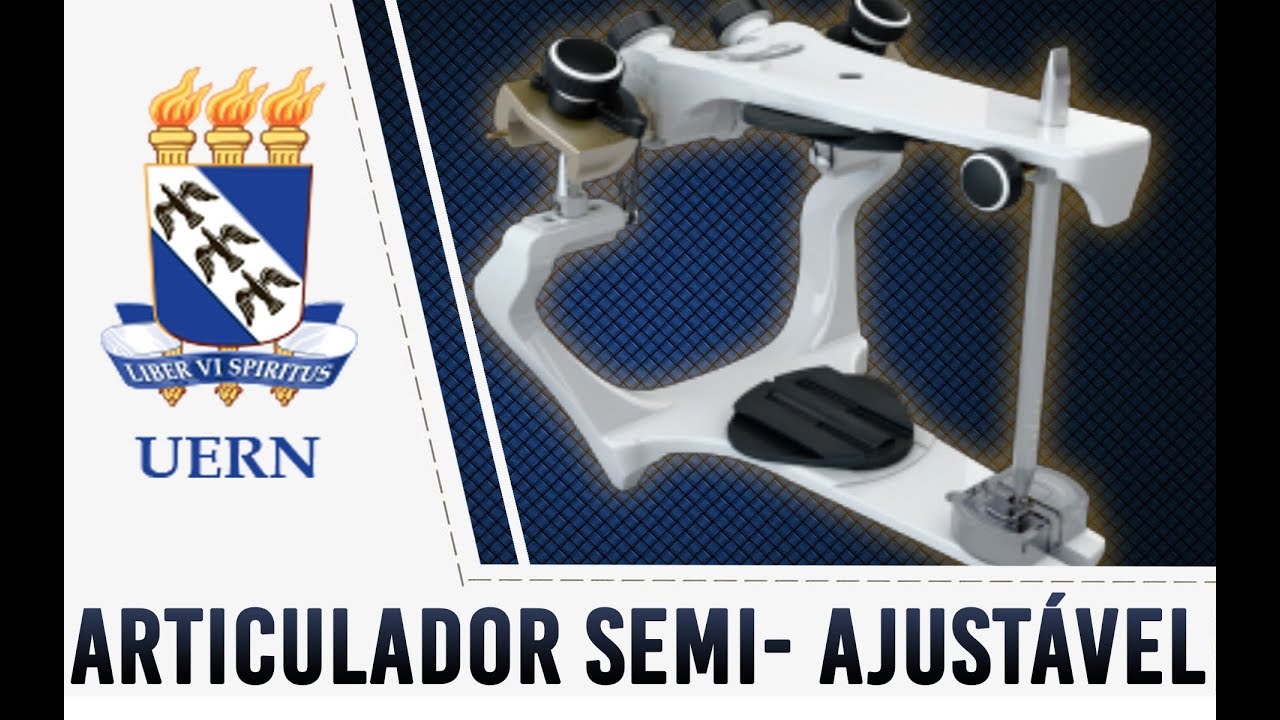 Montagem do Articulador Semi-ajustável(ASA) - UERN