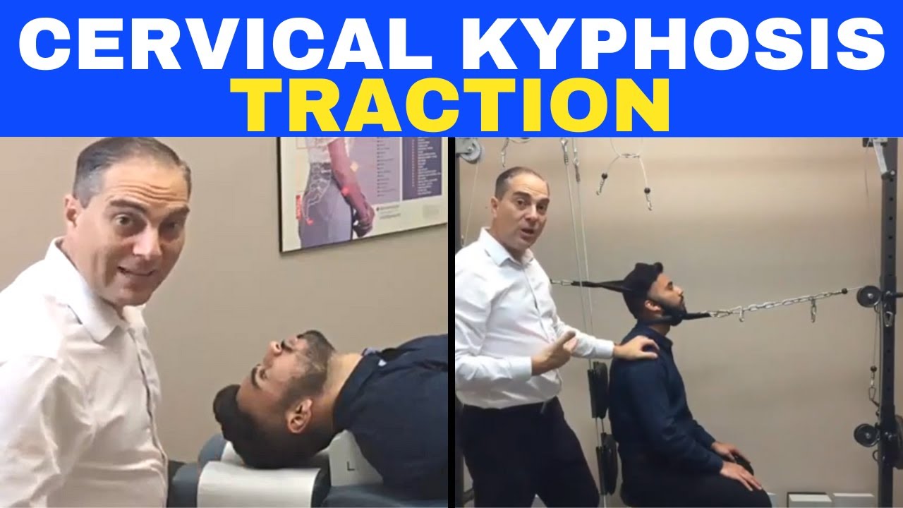 Cervical Kyphosis Traction (Corrective Chiropractic Care) | Dr. Walter Salubro