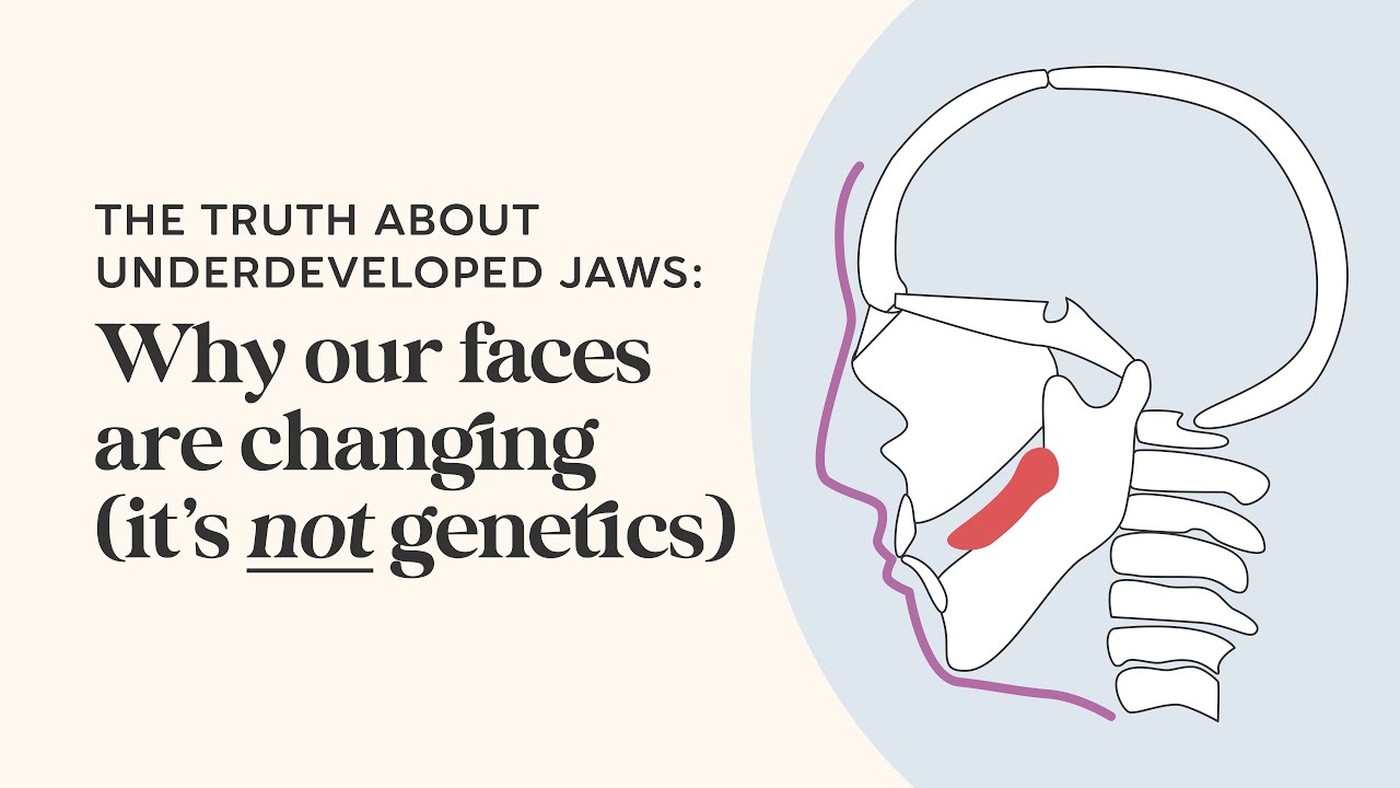 What Causes Underdeveloped Jaws? Dr Ben Miraglia Explains Airway Health & Malocclusion #AirwayHealth