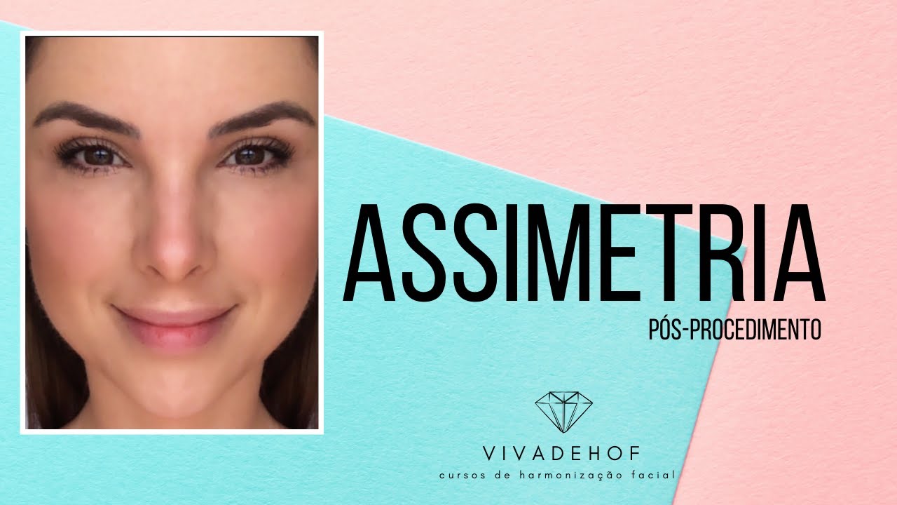 Fiz Botox e a sobrancelha ficou assimétrica, e agora?