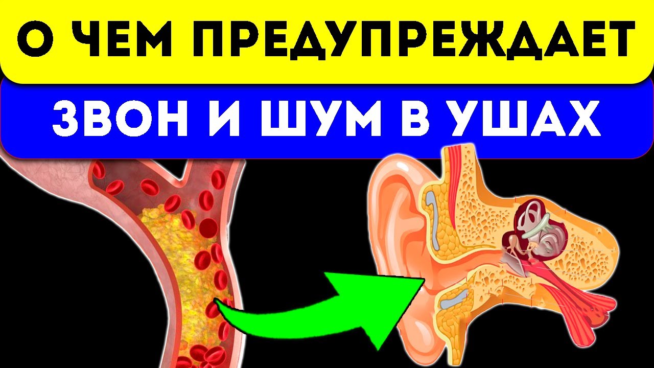 3 капли за ужином и прошел звон в ушах и голове