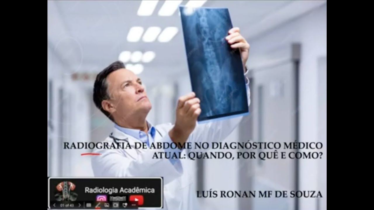 Aula 12 - Raios X do Abdome:2025   Quando, como e porque usar?