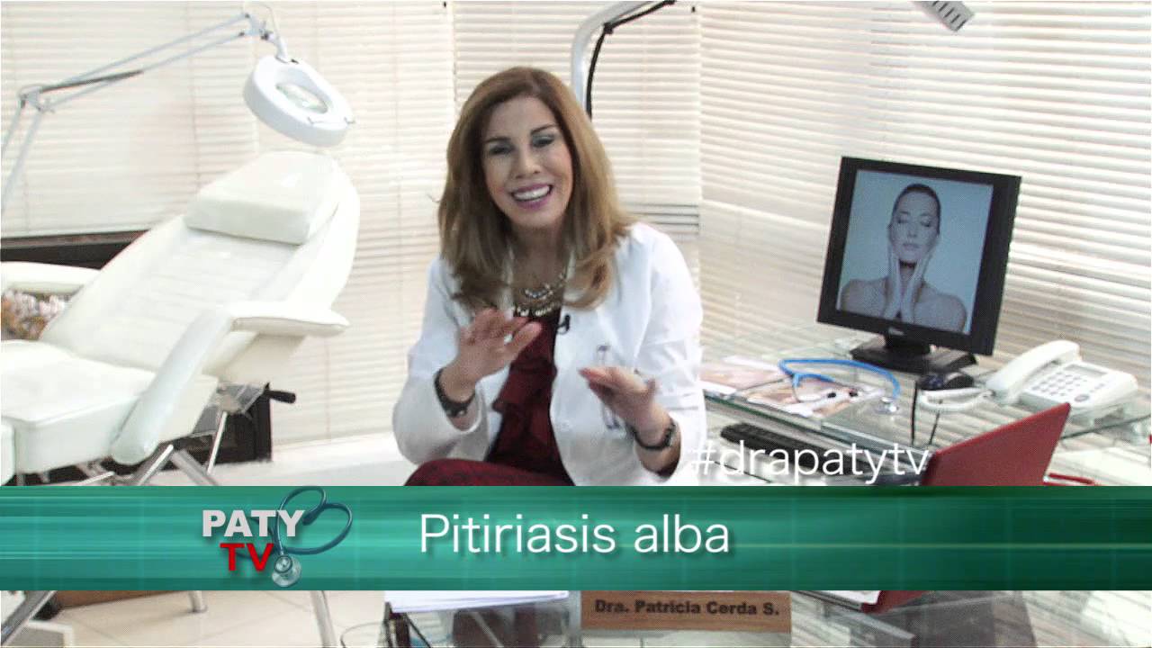 El porqué de la Pitiriasis Alba y su tratamiento - Dra  Paty Tv