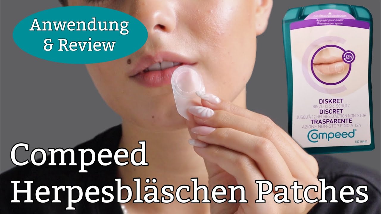 Gamechanger gegen Herpes 🆘 Compeed Herpesbläschen Patches | Anwendung & Review #compeed #herpes