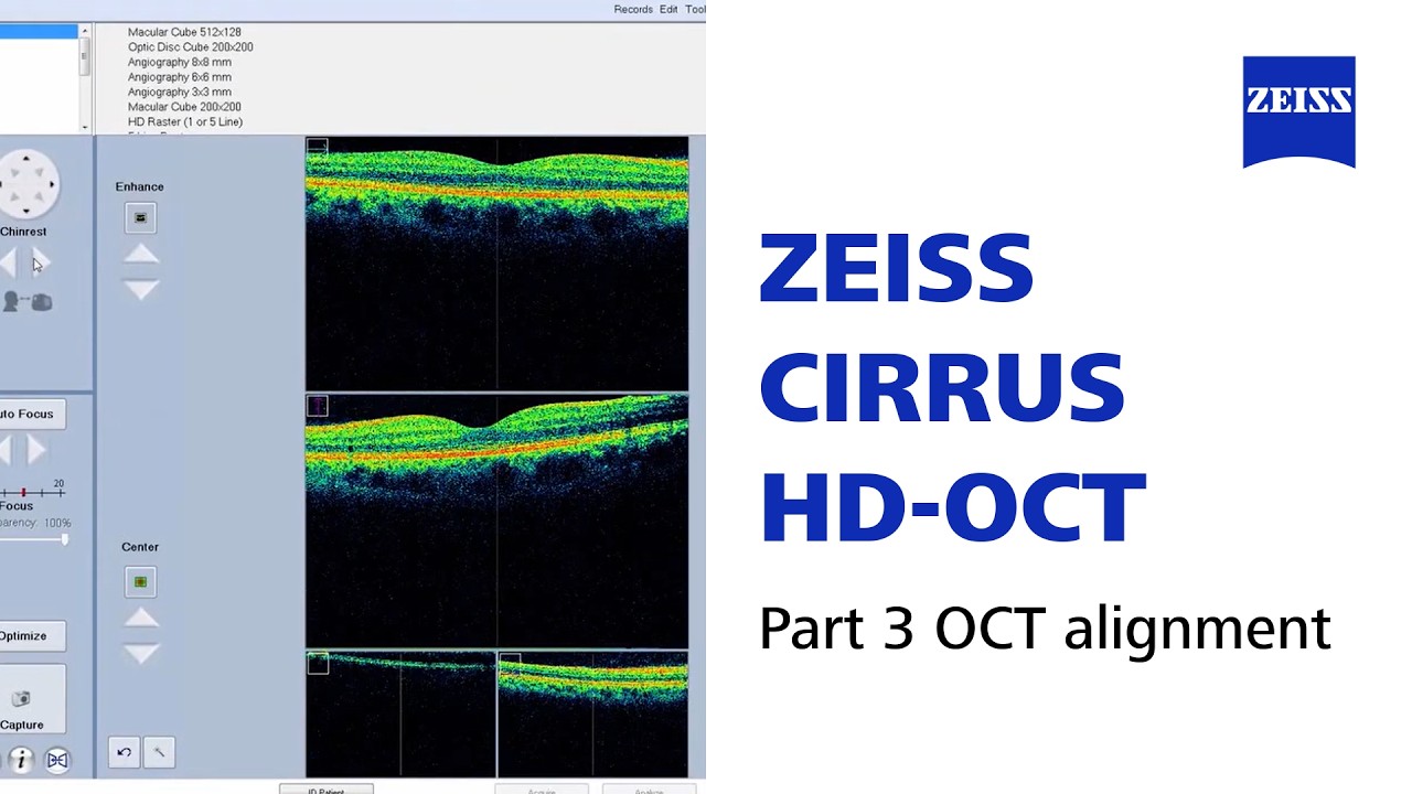 Как получить высококачественное сканирование на моем выравнивании ОКТ CIRRUS HD-OCT Часть 3?