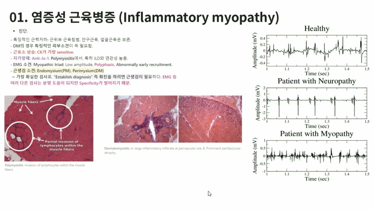 KMLE 강의 시리즈 -  Rheumatology, 4) 염증성 근육병증
