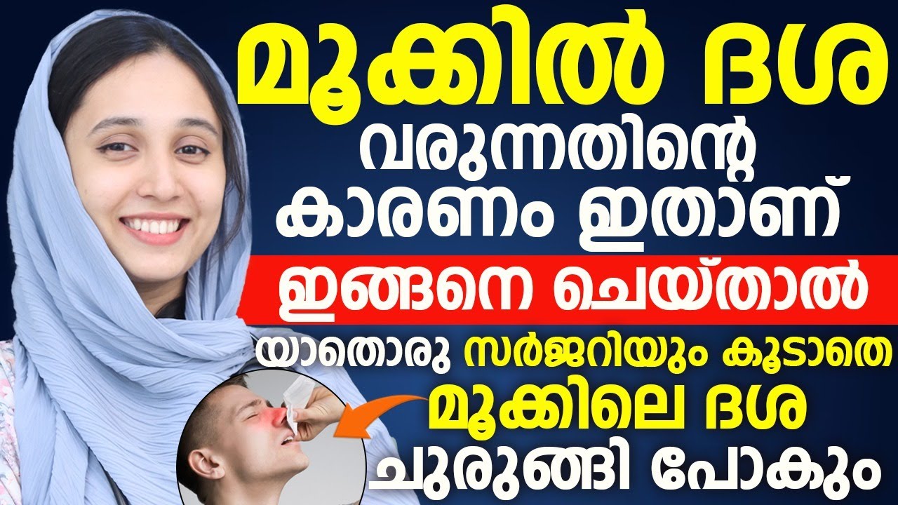 മൂക്കിൽ ദശ | യാതൊരു സർജറിയും കൂടാതെ മൂക്കിലെ ദശ ചുരുങ്ങി പോകും ഇങ്ങനെ ചെയ്താൽ മതി | MOOKKIL DASHA