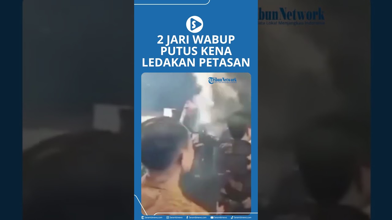 2 Jari Wabup Putus Kena Ledakan Petasan