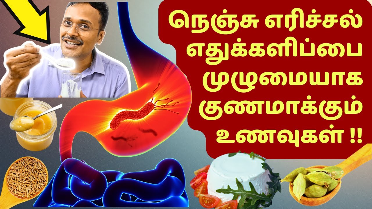 நெஞ்சு எரிச்சல் எதுக்களிப்பு ஏப்பம் பூரண குணமாகும்! GERD acidity reflux foods & Home Remedies!