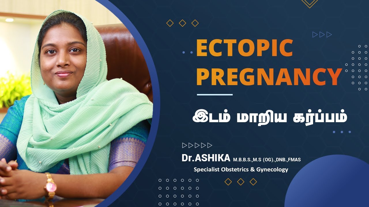 Ectopic Pregnancy in Tamil | கருக்குழாயில் குழந்தை தங்குவதால் ஏற்படும் ஆபத்து ! | Dr. Ashika
