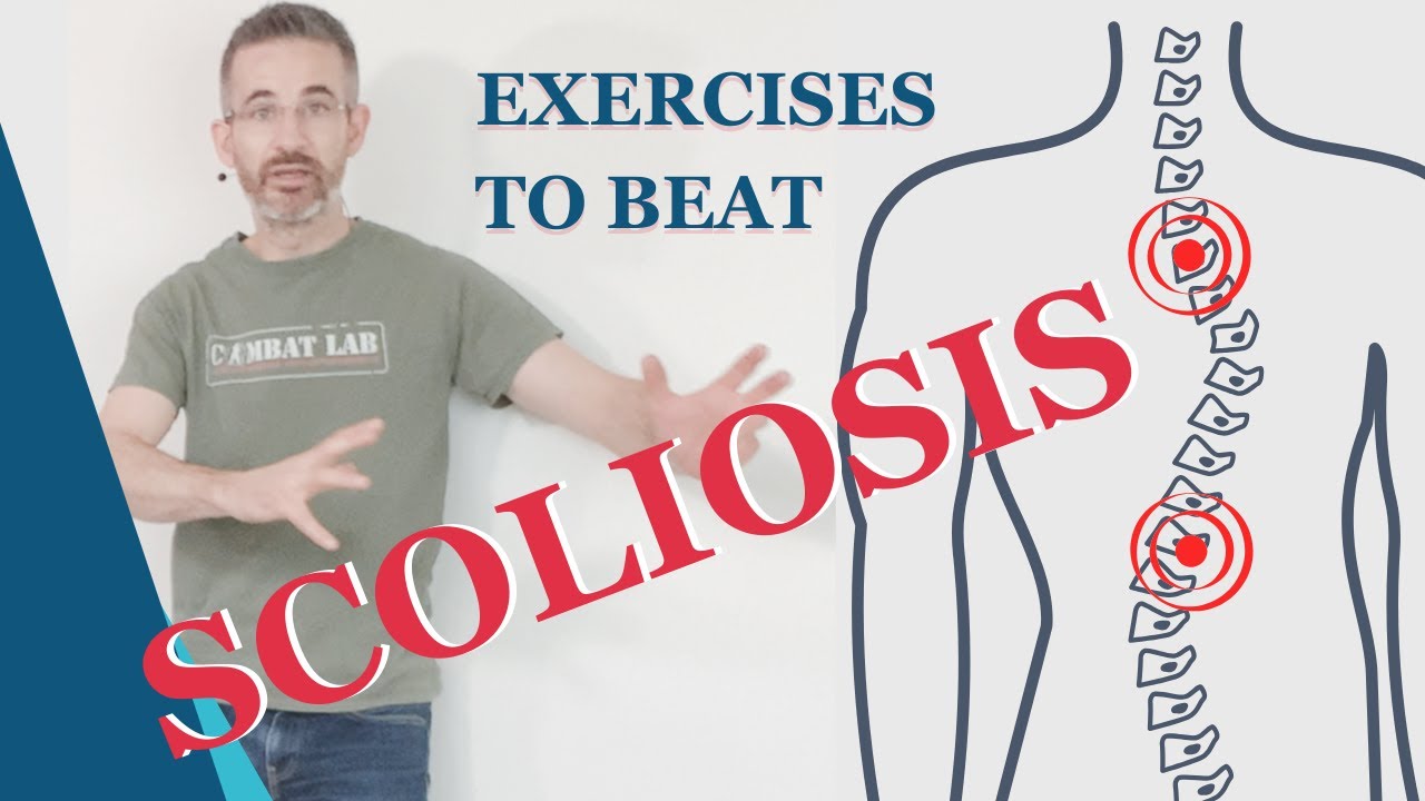 How To Beat Scoliosis Naturally In 4 Minutes A Day - WITHOUT Chiropractor Or Bone Cracking