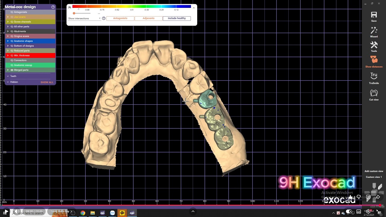 Metal occ design