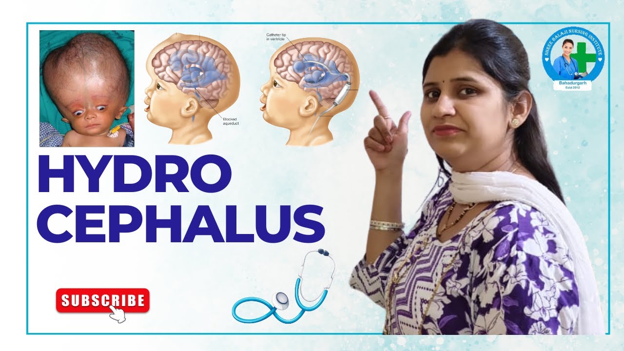 Hydrocephalus | Pooja Mam 