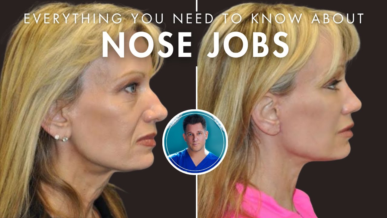 NOSE JOB SURGERY EXPLAINED: WHAT YOU NEED TO KNOW ABOUT RHINOPLASTY AND REVISION RHINOPLASTY
