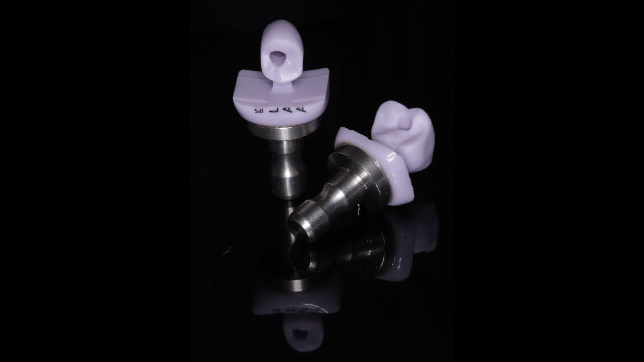 Cementing Cerec Abutment Crown to Tibase