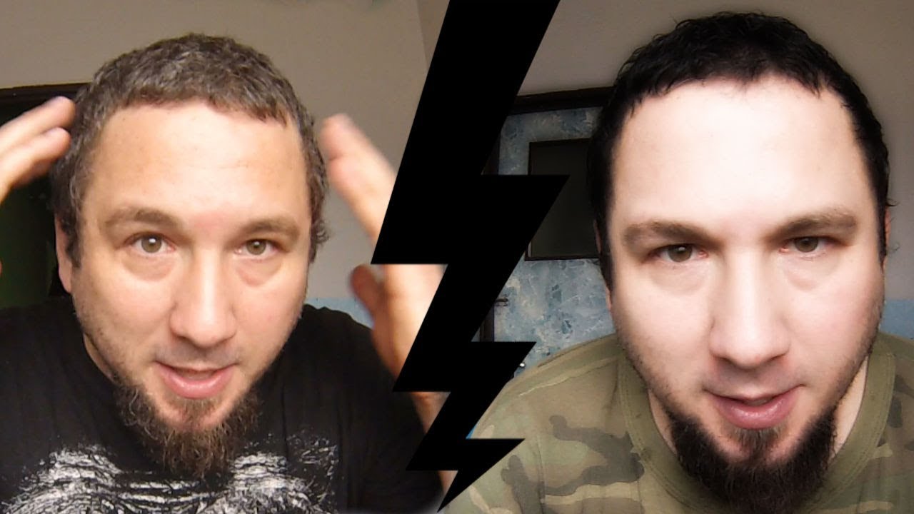 Jak pozbyć się siwych włosów ?