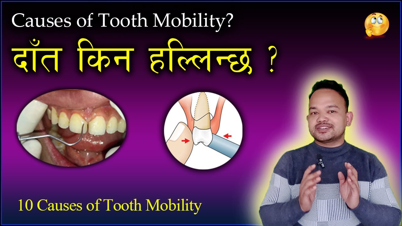 10 Causes of Tooth Mobility // दाँत किन हल्लिन्छ ? Gum disease, tooth extraction #dentist #dental