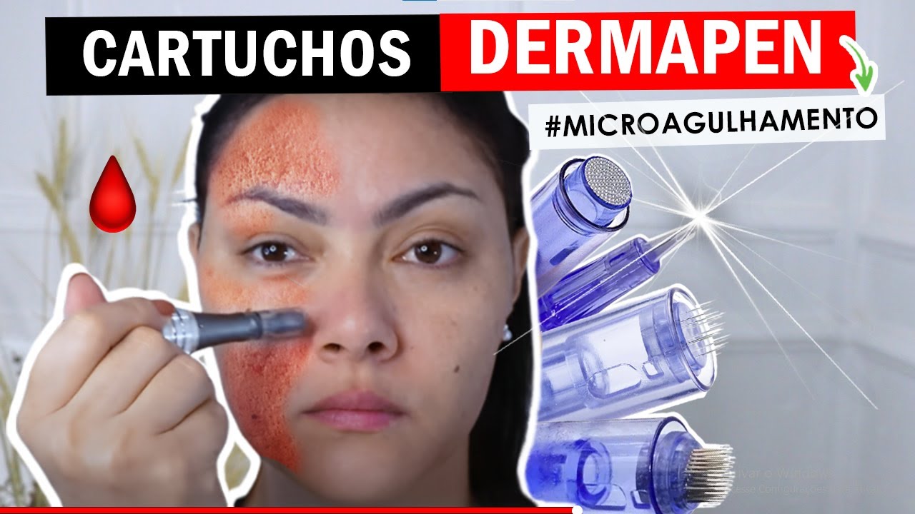 CARTUCHOS para DERMAPEN - Microagulhamento l Quais eu escolho e onde compro?  o que CADA UM FAZ?