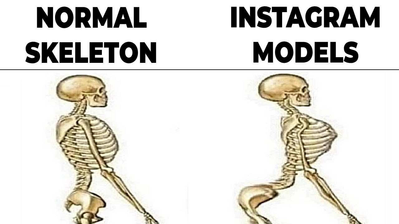 Memes That Teach Me Anatomy