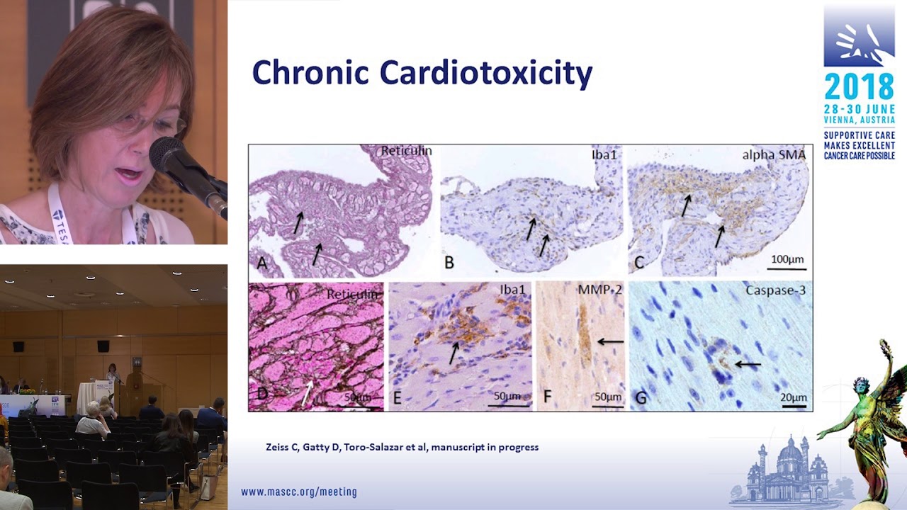 Olga H Toro Salazar - Assessment of Cardiac Injury and Toxicity From Cancer Chemotherapy