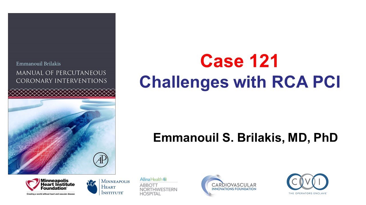 Case 121: PCI Manual - Challenges with RCA PCI
