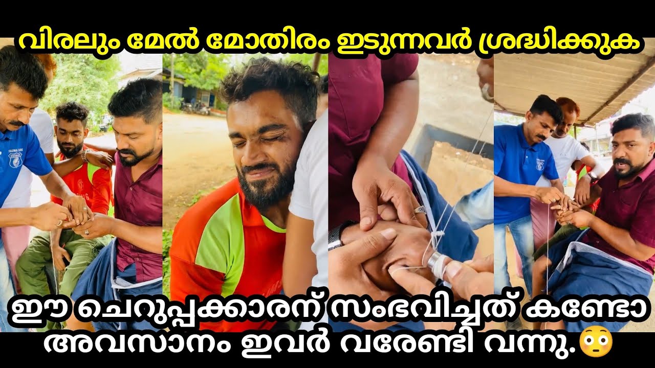 വിരലും മേൽ മോതിരം ഇടുന്നവർ ശ്രദ്ധിക്കുക ഈ ചെറുപ്പക്കാരന് സംഭവിച്ചത് കണ്ടോ അവസാനം ഇവർ വരേണ്ടി വന്നു.😳