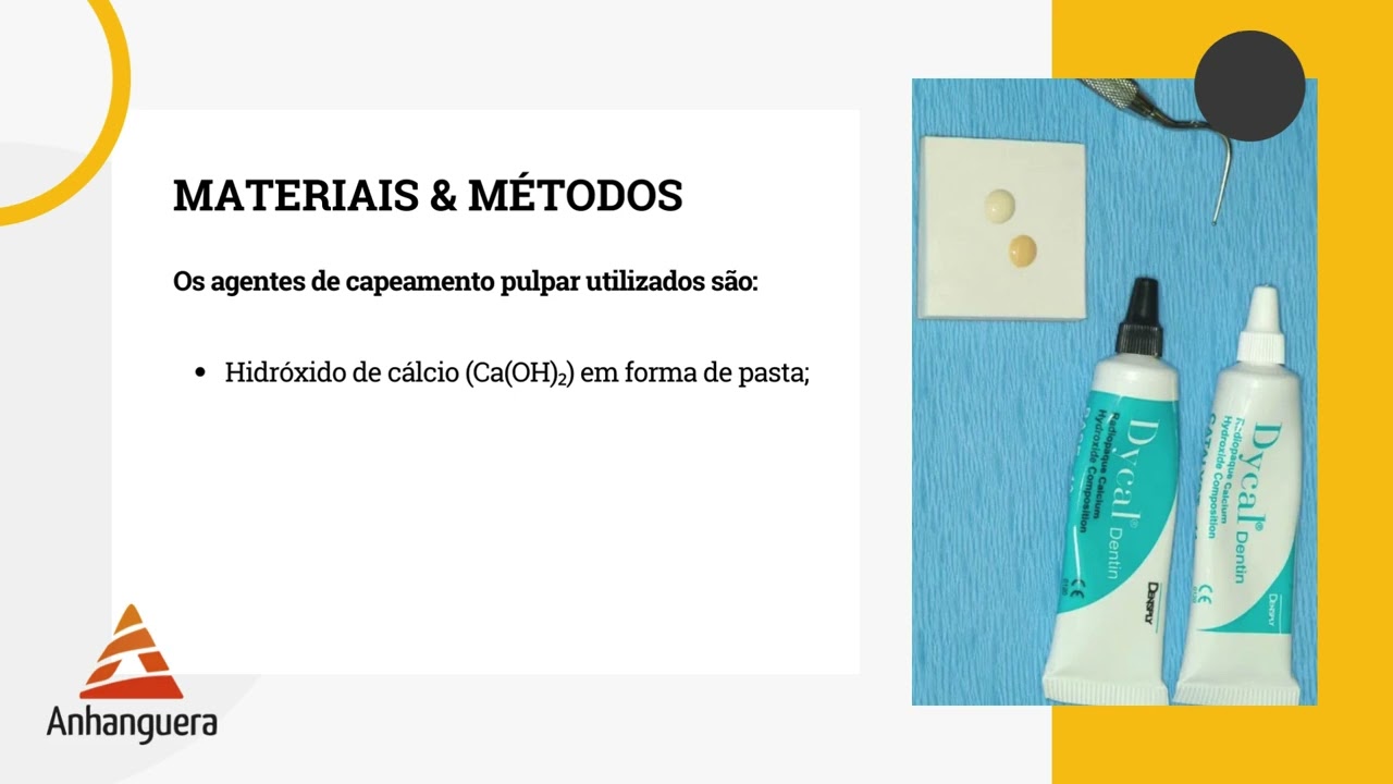 CAPEAMENTO PULPAR INDIRETO - REVIS&Atilde;O DA LITERATURA