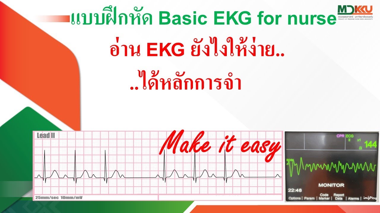 แบบฝึกหัด Basic EKG สำหรับพยาบาล