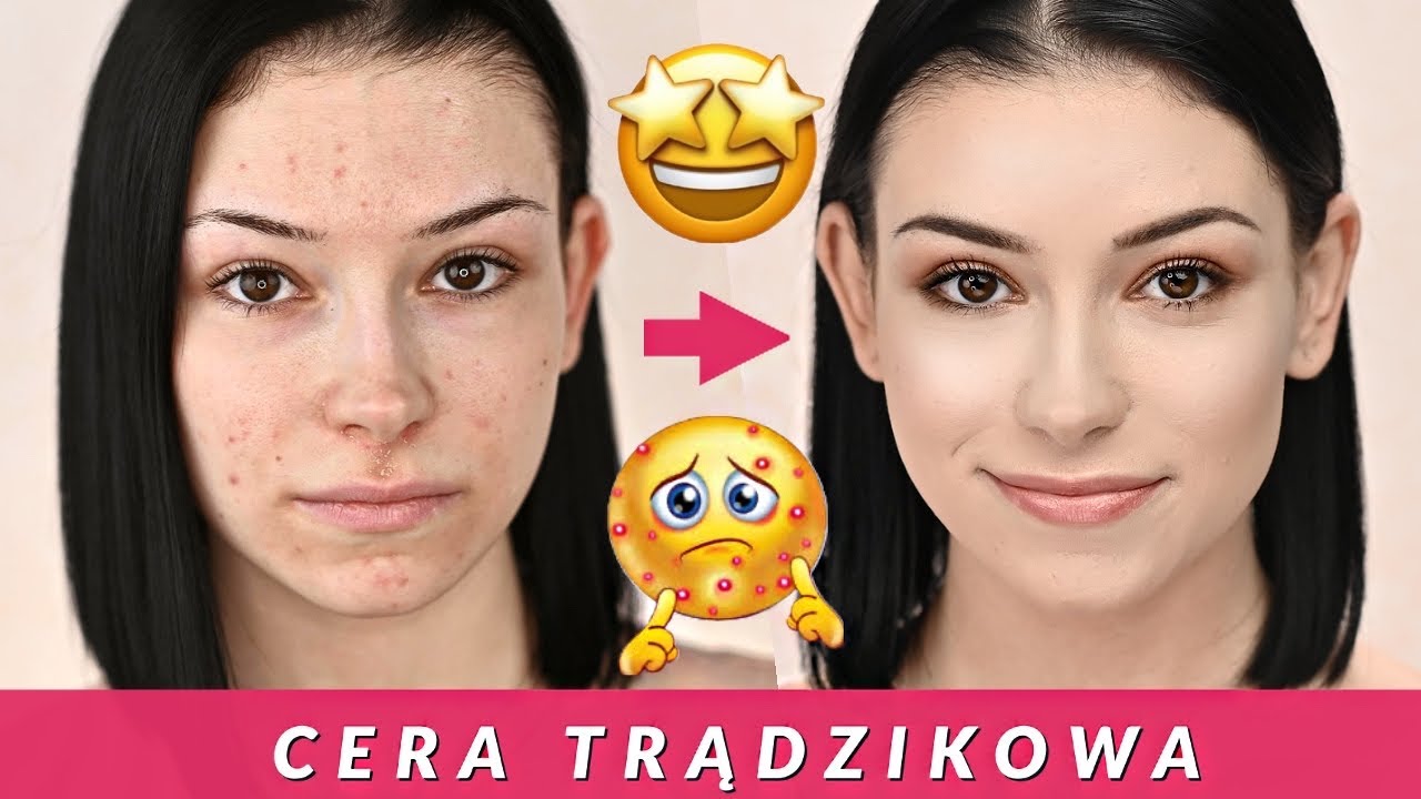 CERA PROBLEMATYCZNA i TRĄDZIKOWA || MAKIJAŻ + PIELĘGNACJA - NA CO ZWRACAĆ UWAGĘ ?