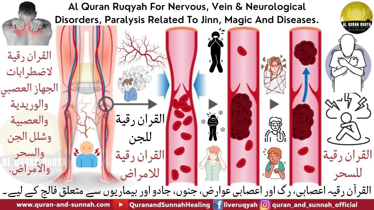 Al Quran Ruqya For Nervous, Vein & Neurological Disorders, Paralysis Related To Jinn, Magic &Disease
