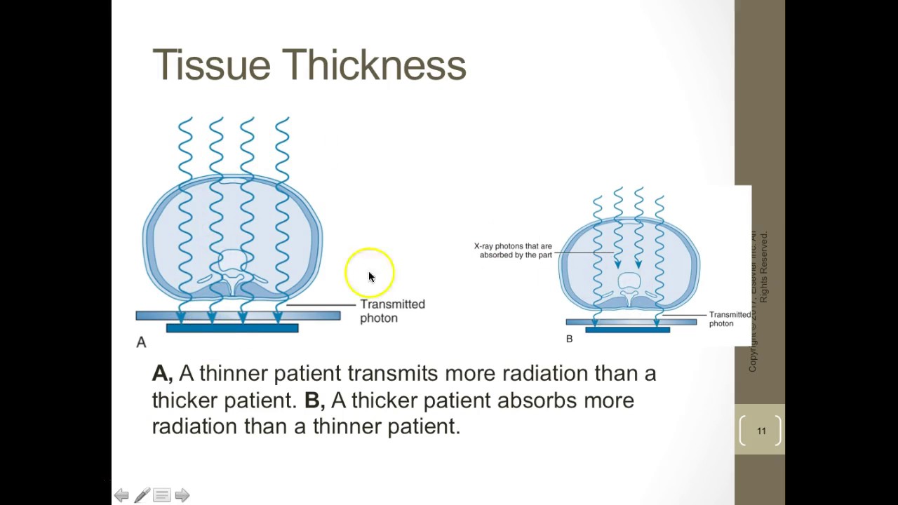 RADT 101 Image Formation and Radiographic Quality