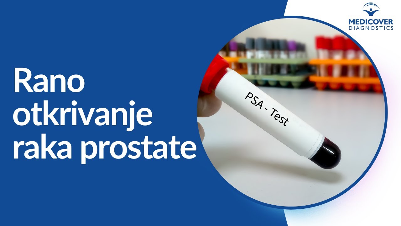 TUMOR MARKERI PROSTATE | Laboratorije Medicover Diagnostics