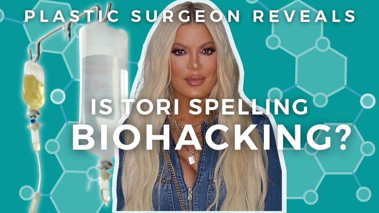 Is Tori Spelling biohacking with stem cells for beauty? Tori Spelling's new plastic surgery.