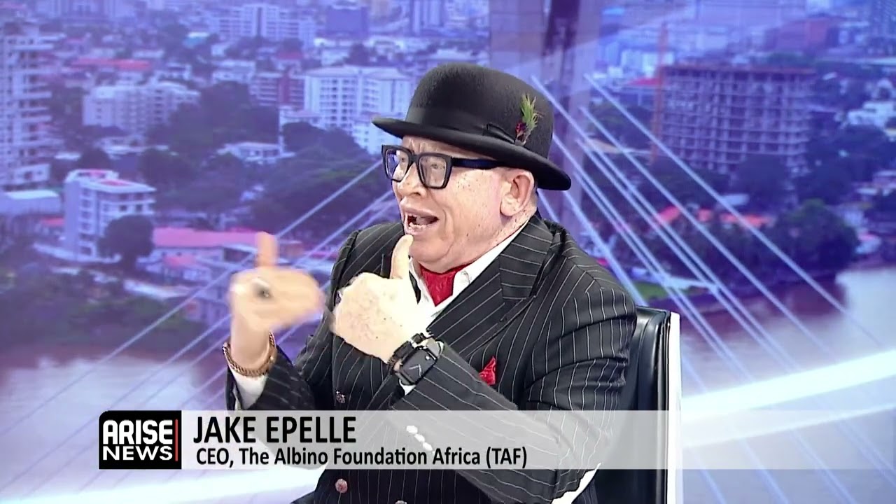 Jamb Concession for Persons With Albinism Still Stands, Undergoing Verification Process - Epelle