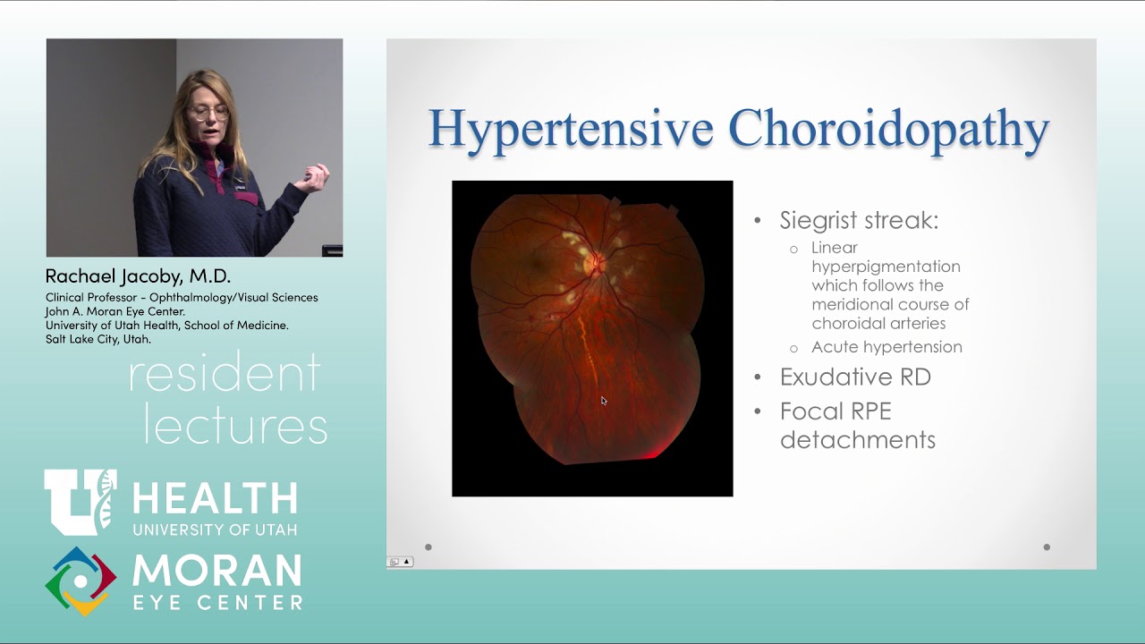 Retinal Vascular Disease: Part 2 of 2
