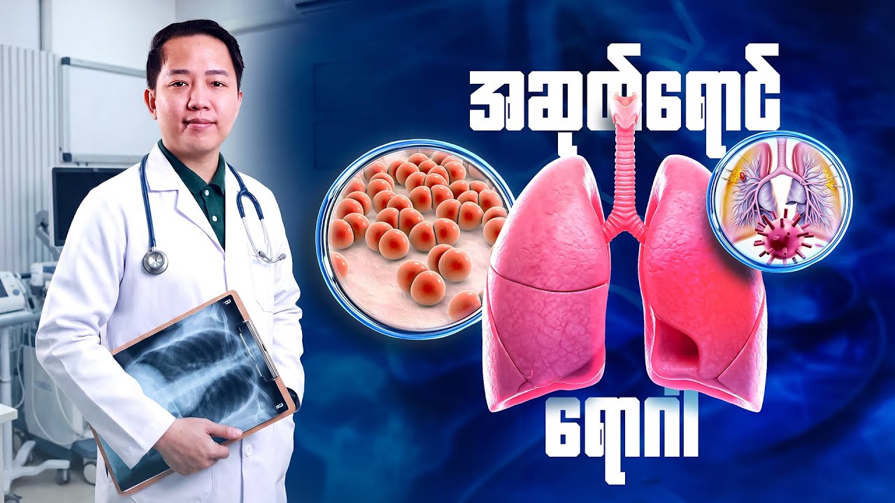 ❓လူတွေသိပ်မသိသေးတဲ့ အဆုတ်ရောင်ရောဂါ ခေါ်  PNEUMONIA(နမိုးနီးယား)ရောဂါအကြောင်း ❓