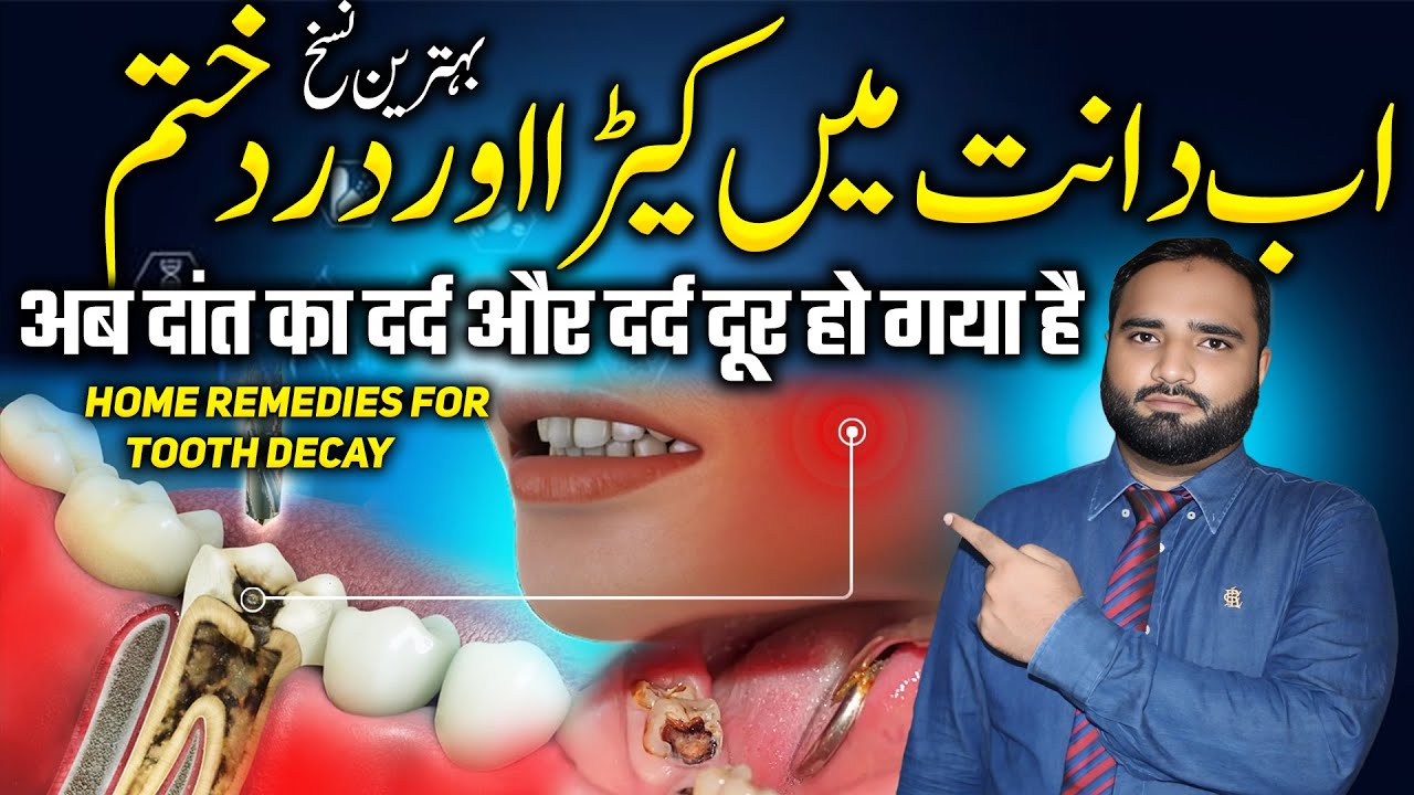 Ab Dant Mein kida aur Dard khatm | Top Home Remedies For Tooth Cavity | cavities in teeth