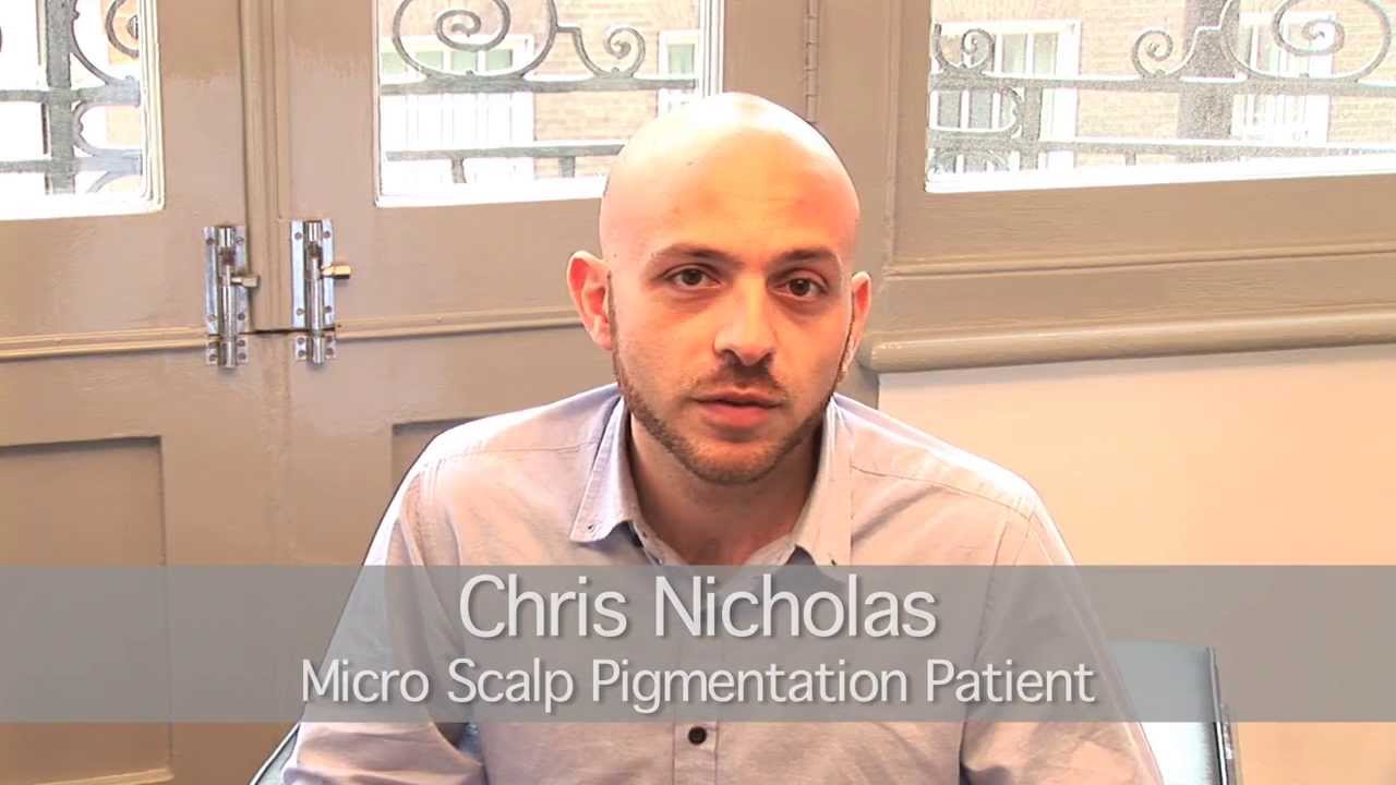 Scalp Micro Pigmentation (SMP)  London